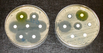 Antibiotic Resistance, Photo: Wikimedia Commons